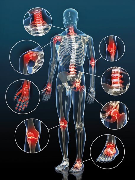 Quelles sont les causes des douleurs articulaires ?